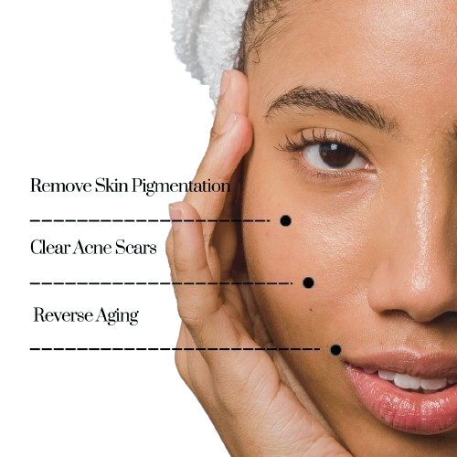 Skincare benefits: pigmentation removal, acne scar clearing, aging reversal